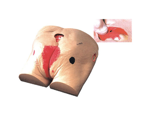 高級壓瘡(褥瘡)護理模型