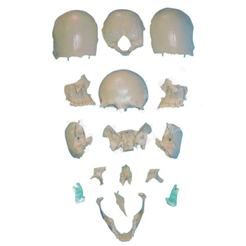 部分顱骨散骨模型