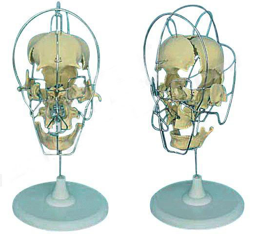 成人分離頭顱骨模型