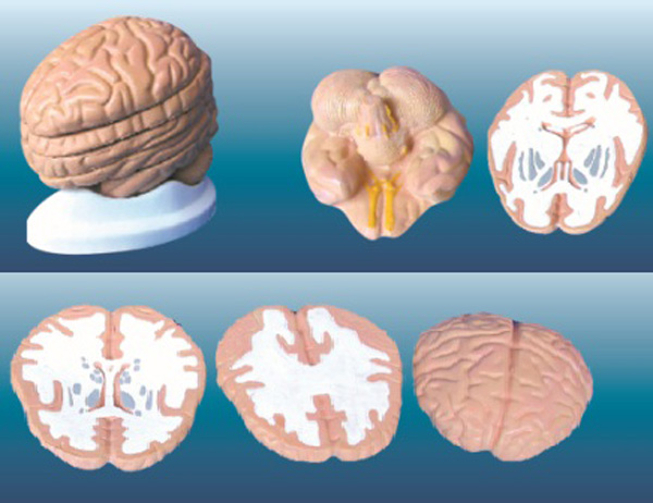 腦水平切面模型