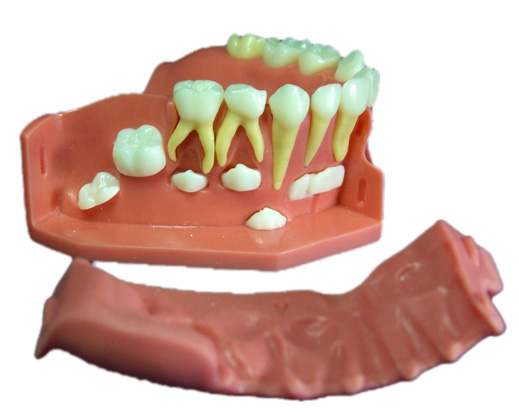 牙列發(fā)育模型B